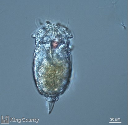 Photo of Brachionus